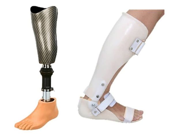 Prótese X Órtese: qual a diferença?